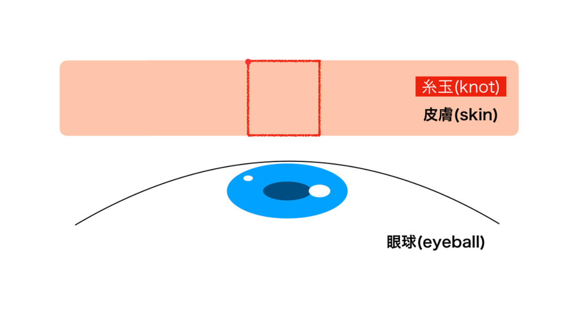2点留め解説図
