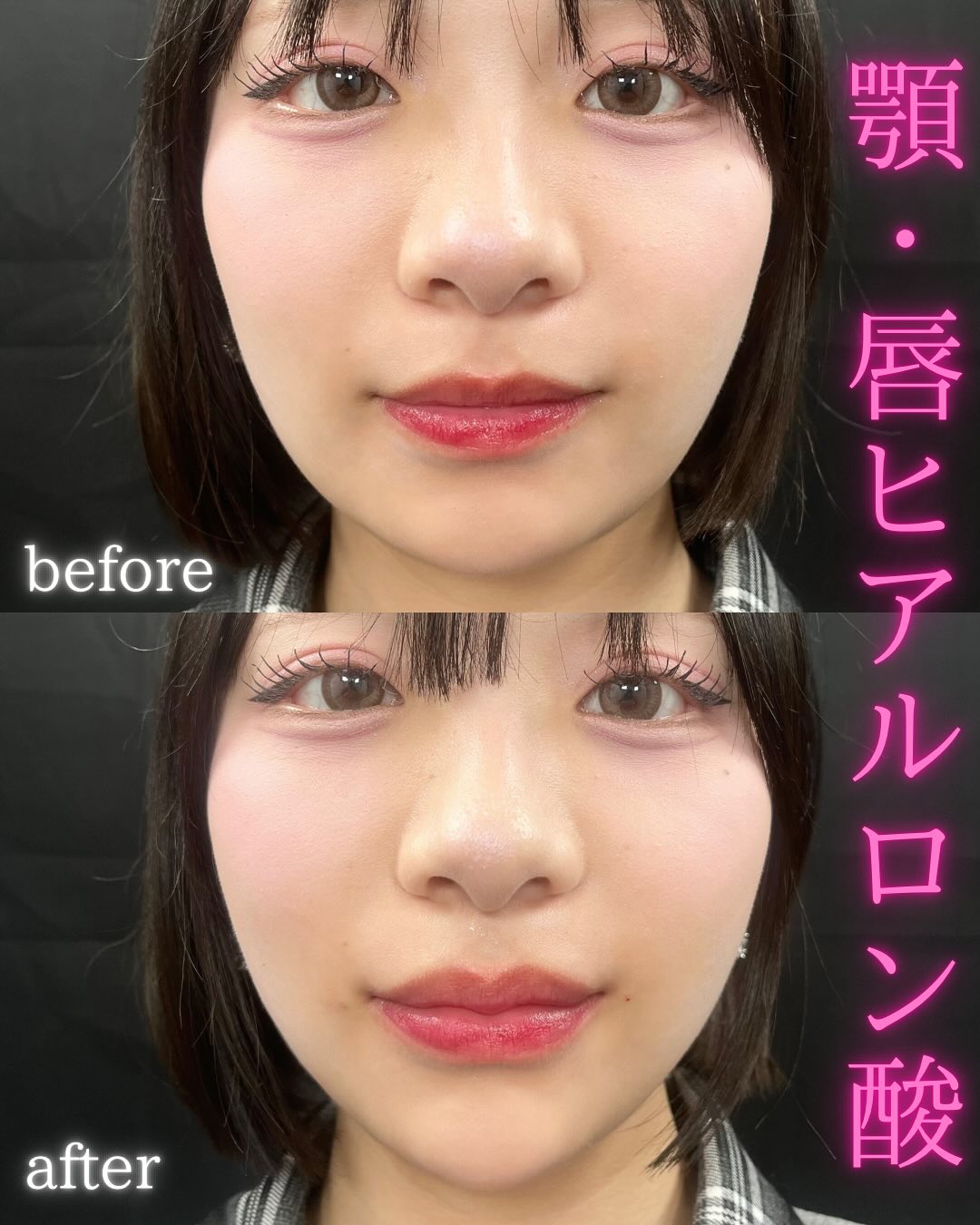 症例写真