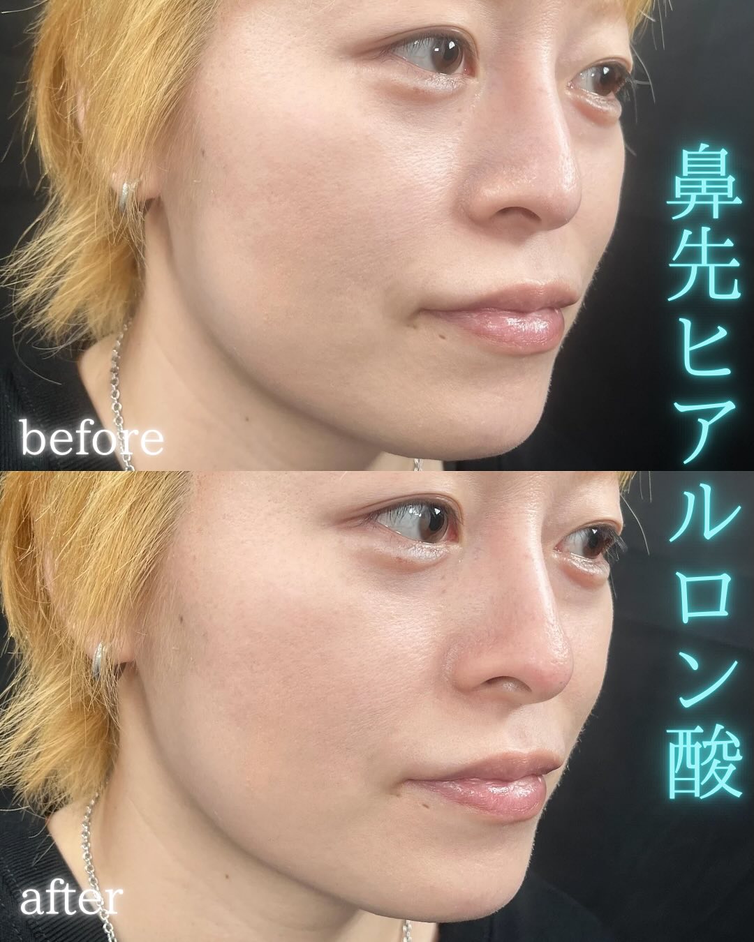 症例写真